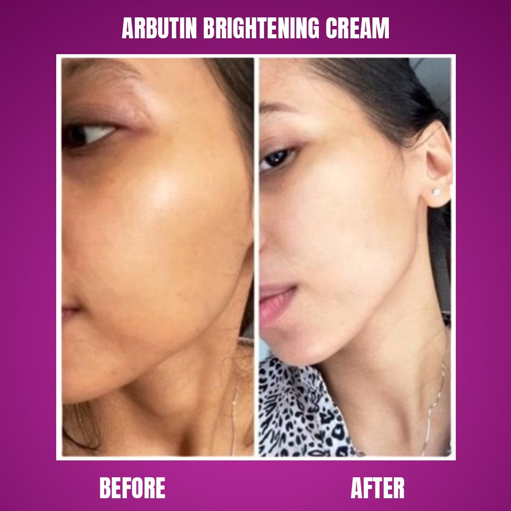 Arbutin Brightening Cream (Glutathione) Arwa Skin Care